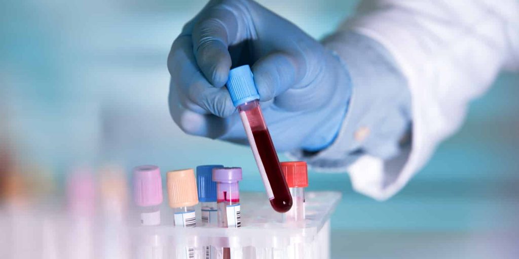 A lab technician performing DUI blood testing