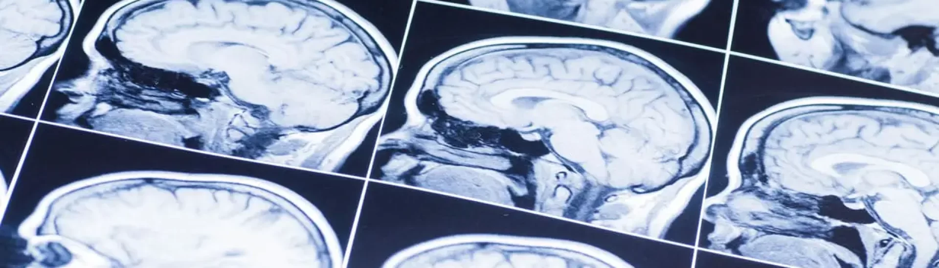 MRI scans of human brains showing various angles and structures, relevant to traumatic brain injury analysis.